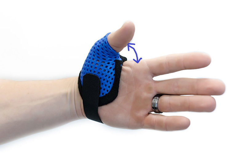 CMC Arthritis Orthosis in the Hand CMC orthosis
