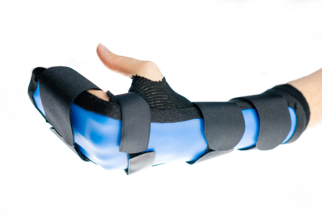 dorsal blocking orthosis