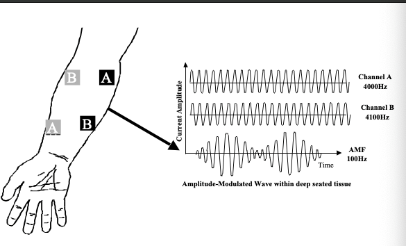 Optimal Healing with a Home Use Mini TENS Physiotherapy Pain