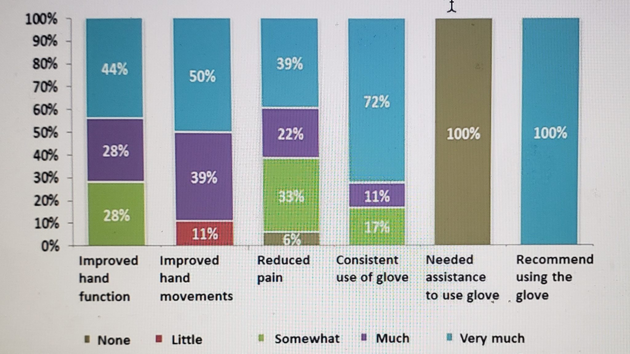 Compression Gloves for Swelling After Surgery