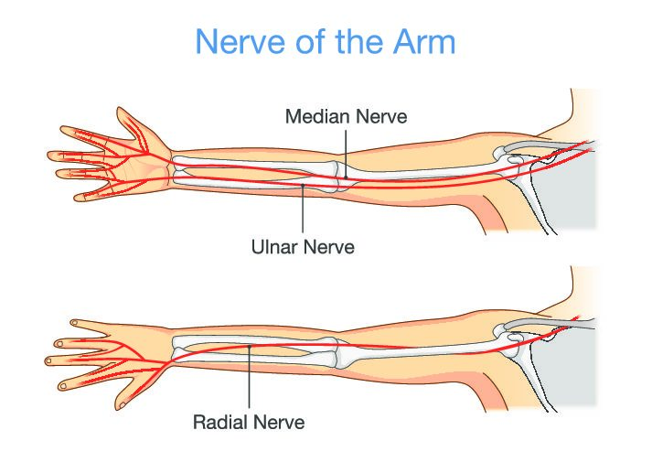 Differentiating Proximal Median Nerve Entrapment from CTS