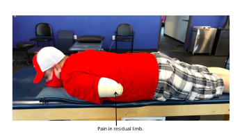 residual limb pain