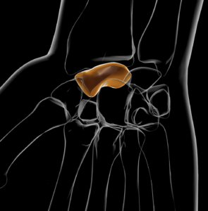 most common carpal bone fracture