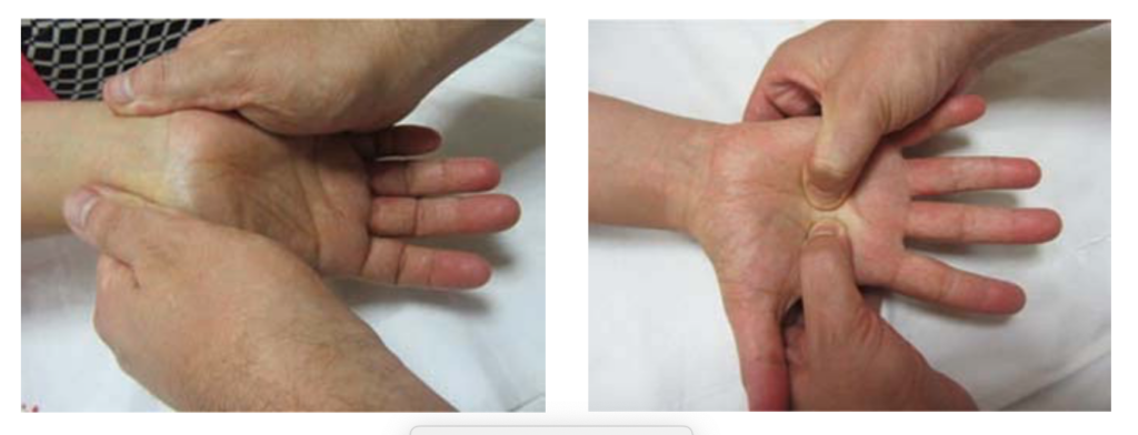 manual therapy for carpal tunnel