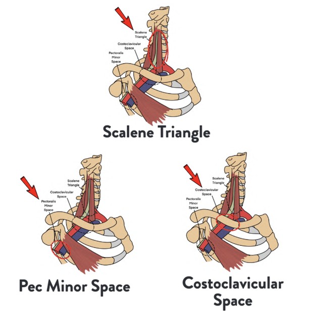 Shoulder Pain Rehab