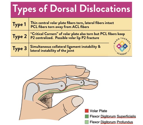 Common PIP Joint Diagnoses E-book