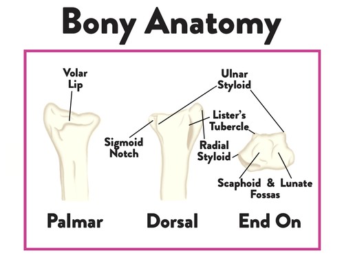 Distal Radius Fracture Training E-Book