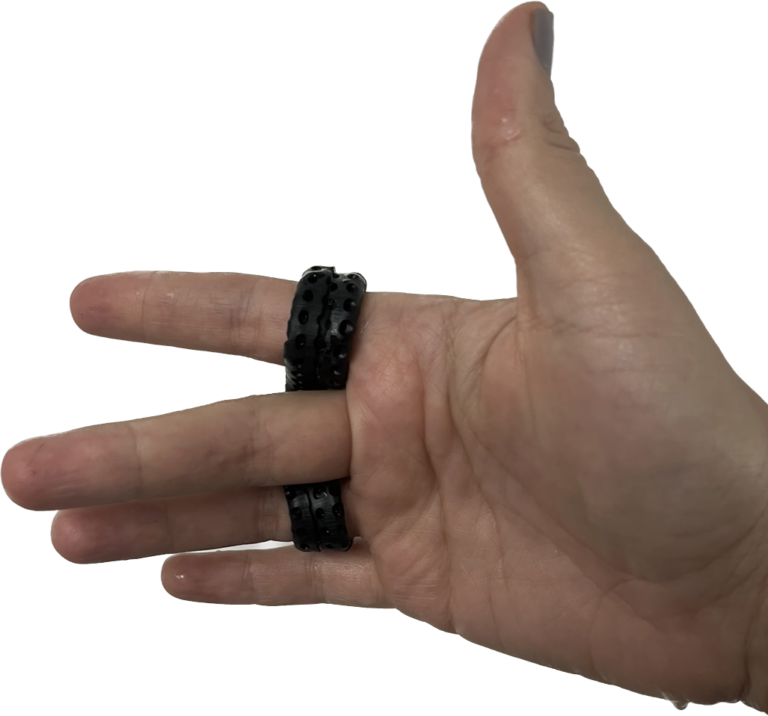 What are the splinting options for stiff finger joints?