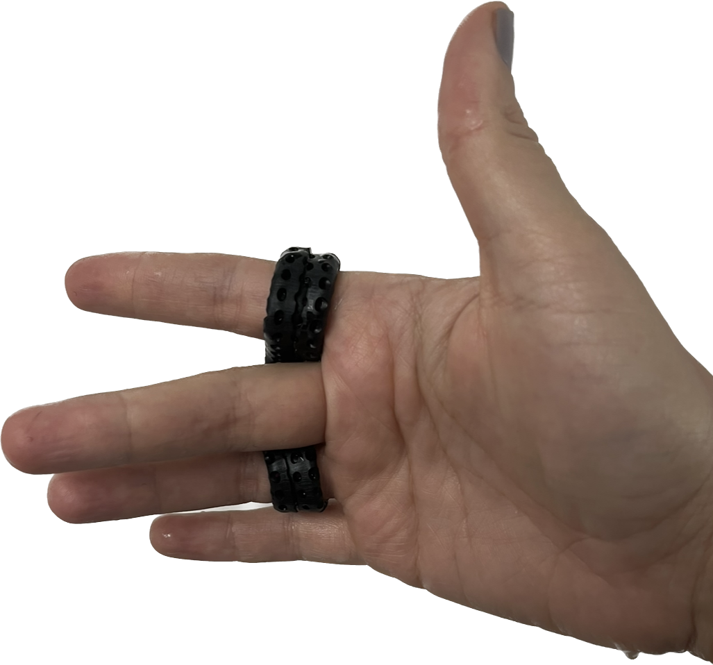 What are the splinting options for stiff finger joints?