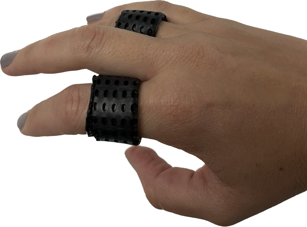 What are the splinting options for stiff finger joints?