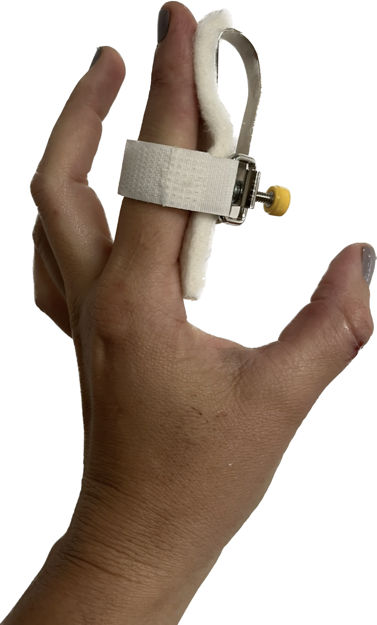 What are the splinting options for stiff finger joints?