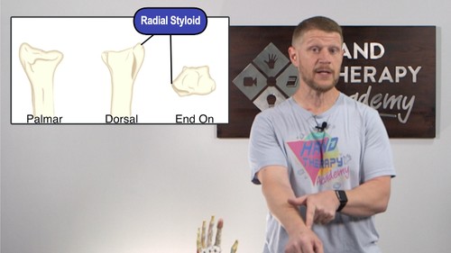 Entrenamiento sobre fracturas del radio distal