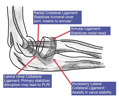 Elbow LCL Treatment | Hand Therapy Academy