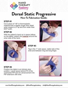 Discovering Dupuytren’s Disease | Hand Therapy Academy