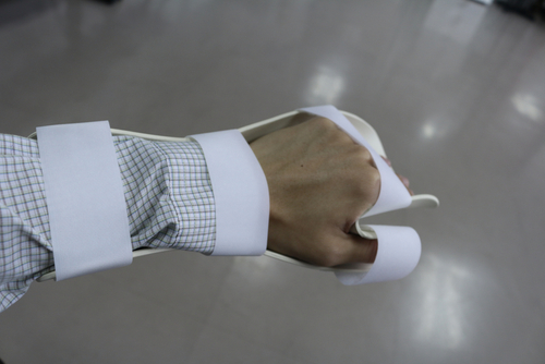 hand spasticity