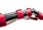 Orthosis Fabrication Course 6
