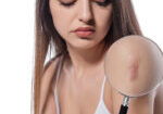 Woman,Holding,Magnifying,Glass,And,Showing,Surgery,Scar.,Scars,Removal