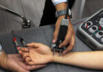 Doctor's,Hands,Conducting,Electromyography,Study,And,Nerve,Conduction,In,Young