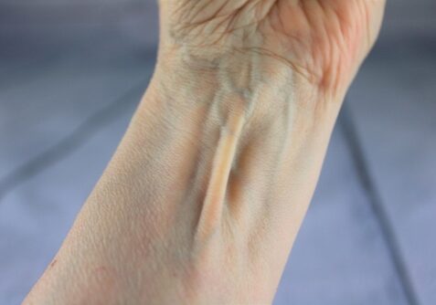 Palmaris Longus Muskel,,Sichtbare,Sehne,Befindet,Zwischen,Dem,Flexor,Carpi