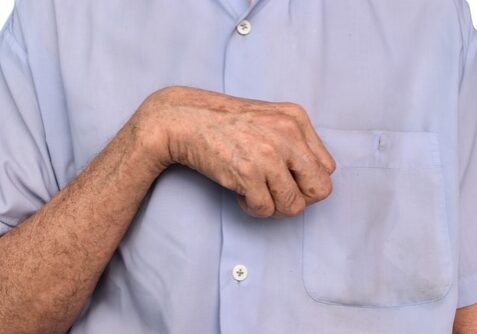 Hand,Muscle,Rigidity,And,Finger,Flexion,Of,Asian,Elder,Man.