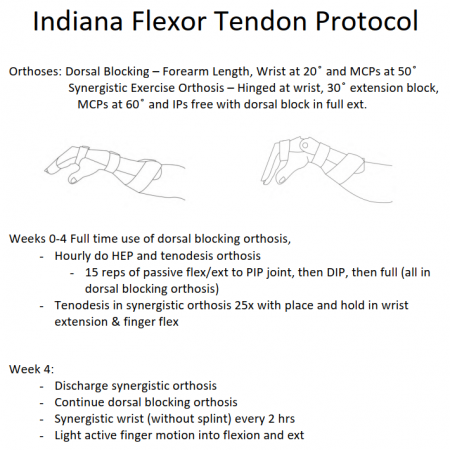 Flexor Tendon Treatment