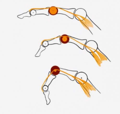 Zones des tendons extenseurs Zones des tendons extenseurs