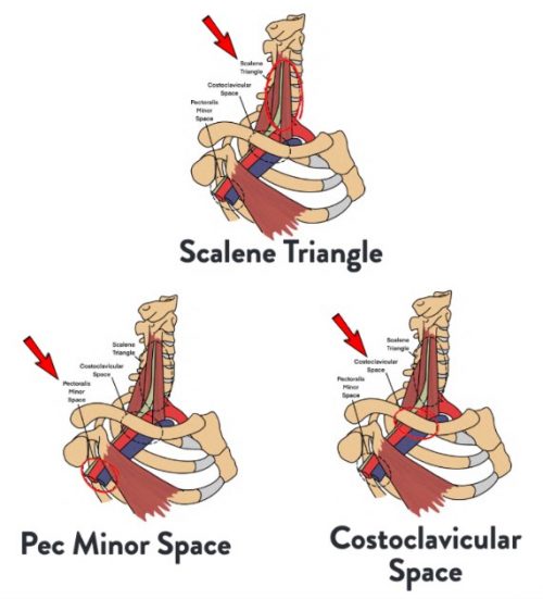 Shoulder Pain Rehab