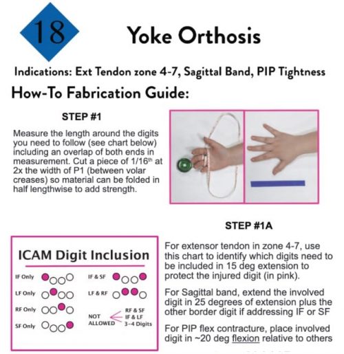 Hand Therapy Splinting