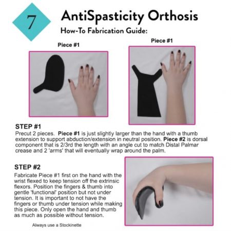 Hand Therapy Splinting