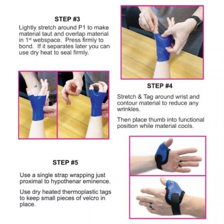 Hand Therapy Splinting