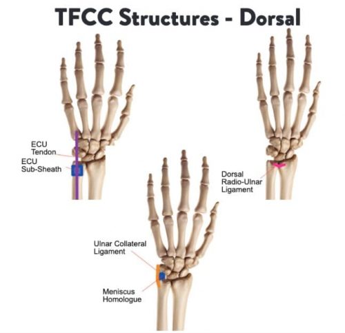 Ulnar Sided Wrist Pain