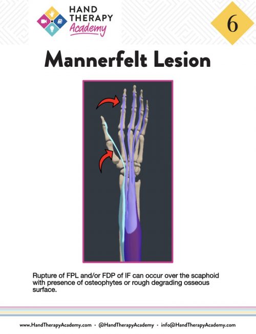 Tendon Transfer Training E-Book