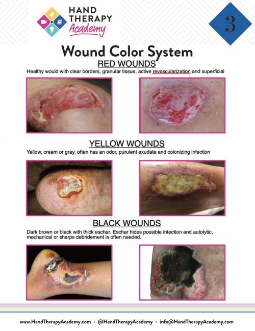 wound care in hand therapy 03
